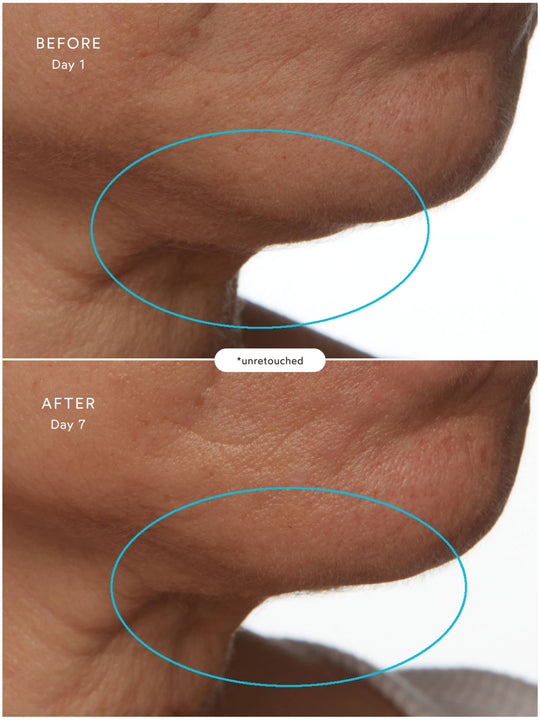 SuperSEA Firming & Lifting Treatment