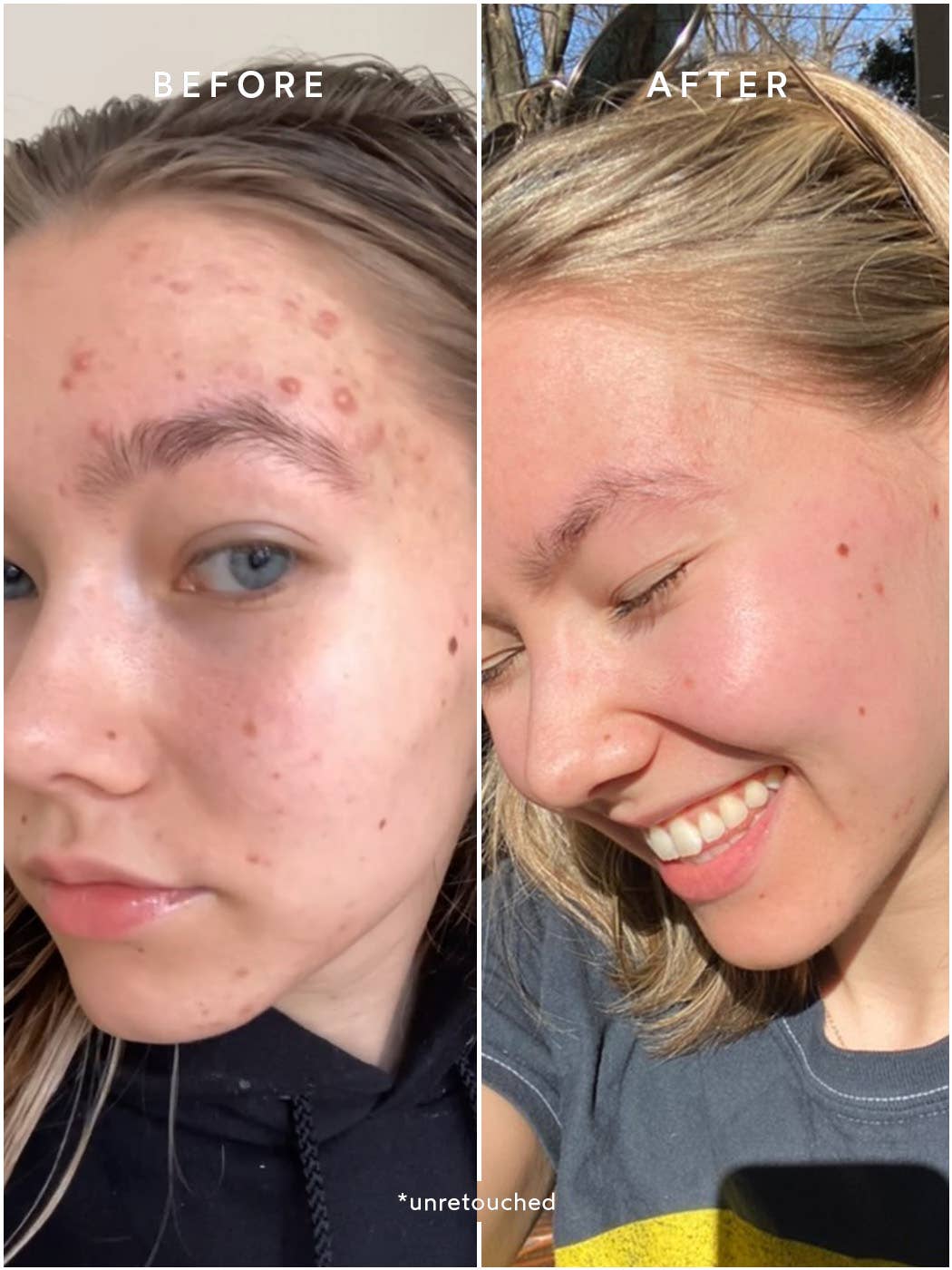 Clear - Pure Radiance Oil