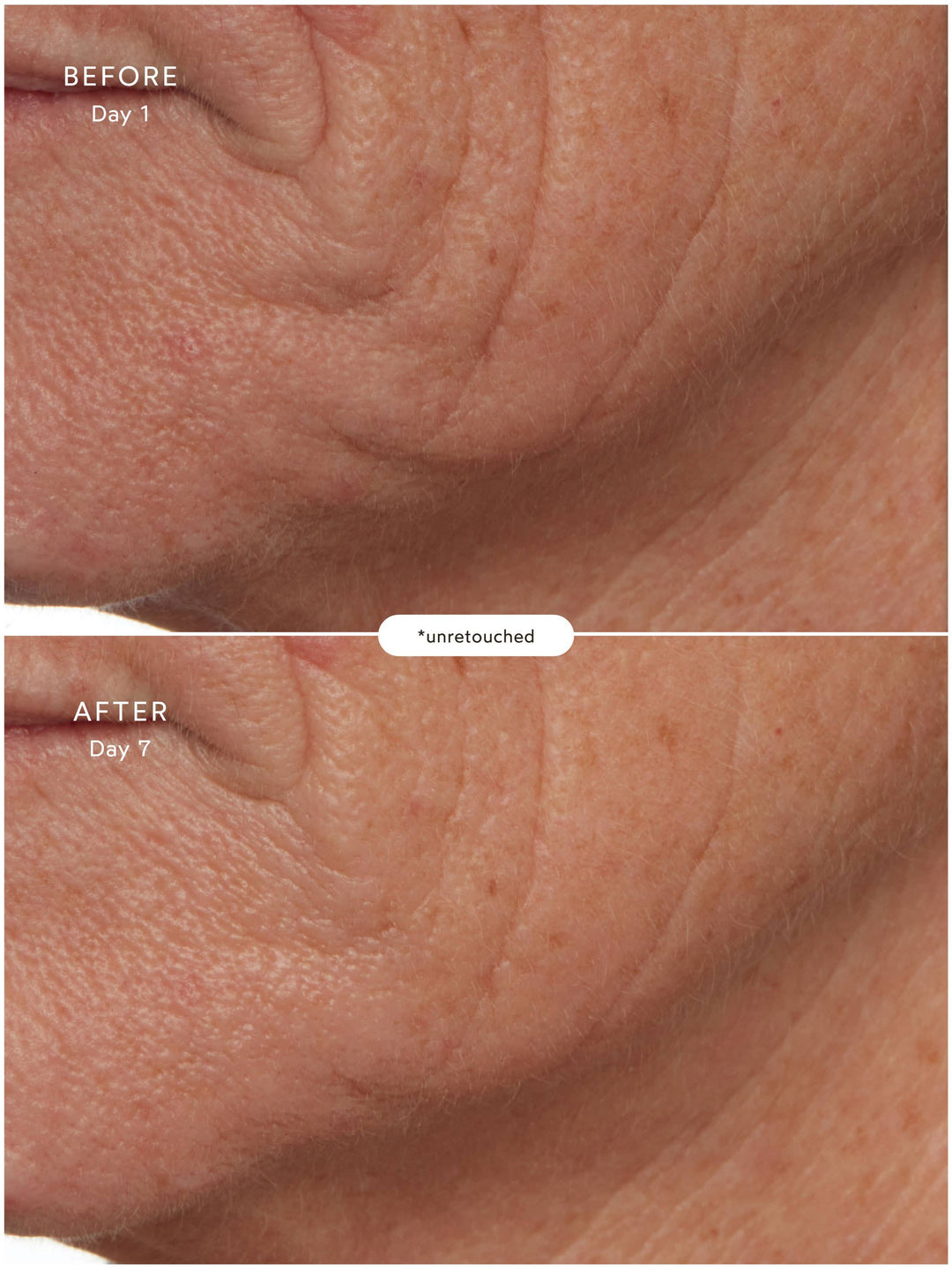 SuperSEA Firming & Lifting Treatment