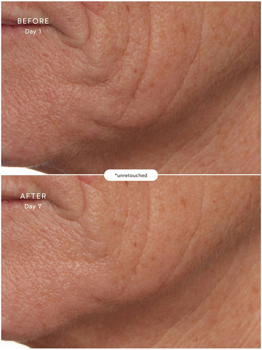 SuperSEA Firming & Lifting Treatment
